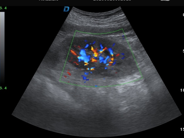 Kidney imaging