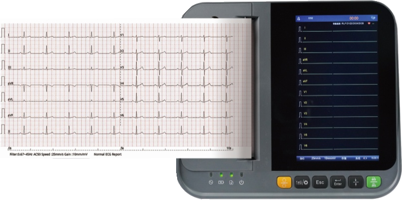 https://www.ultrasounddawei.com/12-channel-ecg-machine-product/