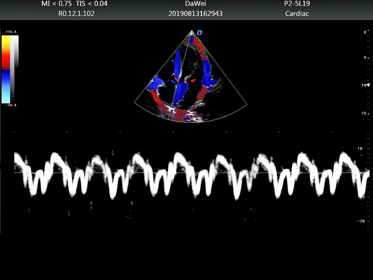 https://www.ultrasounddawei.com/dw-p8-product/