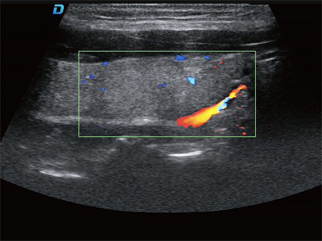 Trapezoidal Imaging