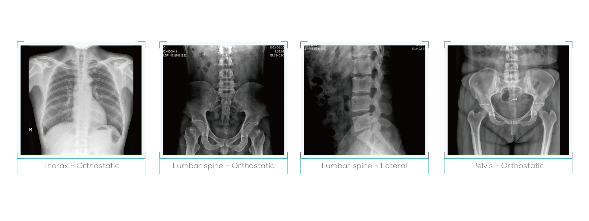 https://www.ultrasounddawei.com/news/a-new-chapter-for-dawei-medical-digital-x-ray-machine/