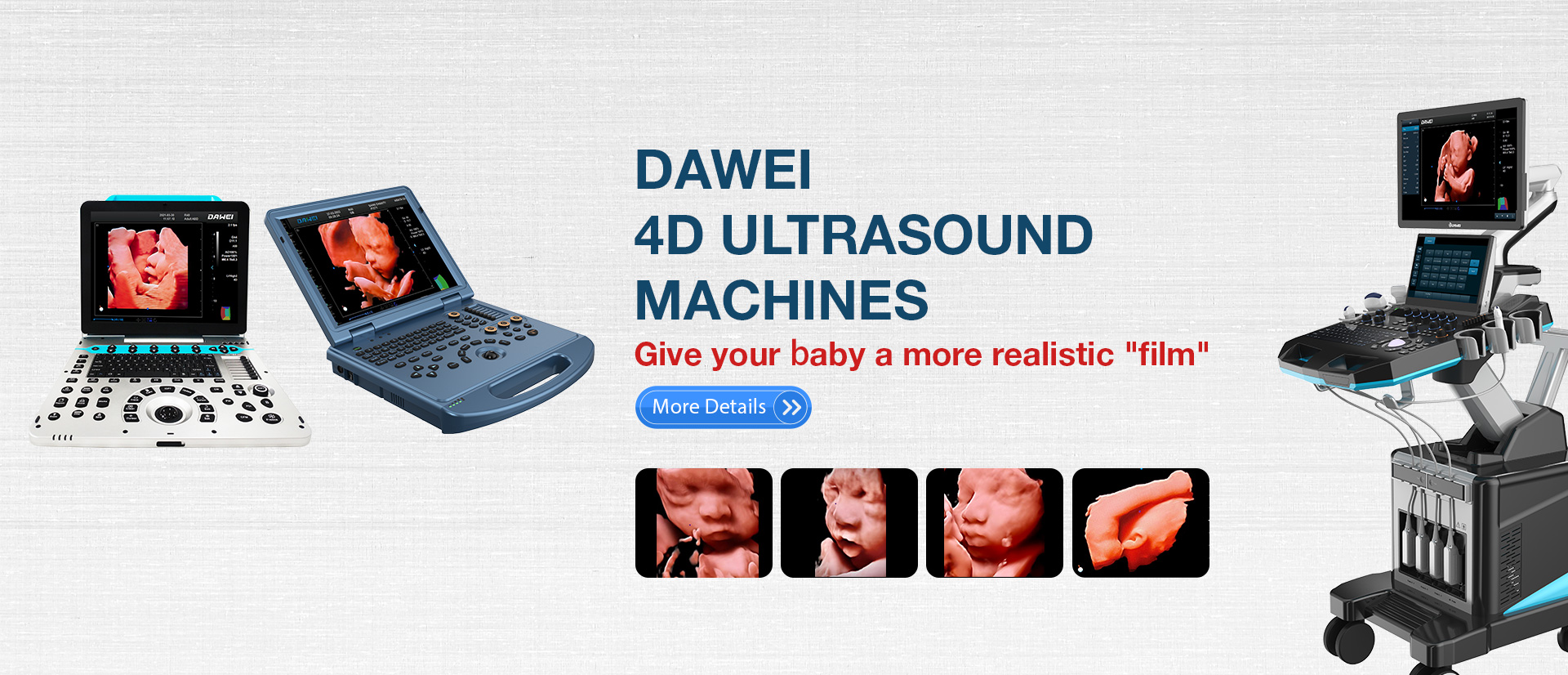 4D Ultrasound Machines