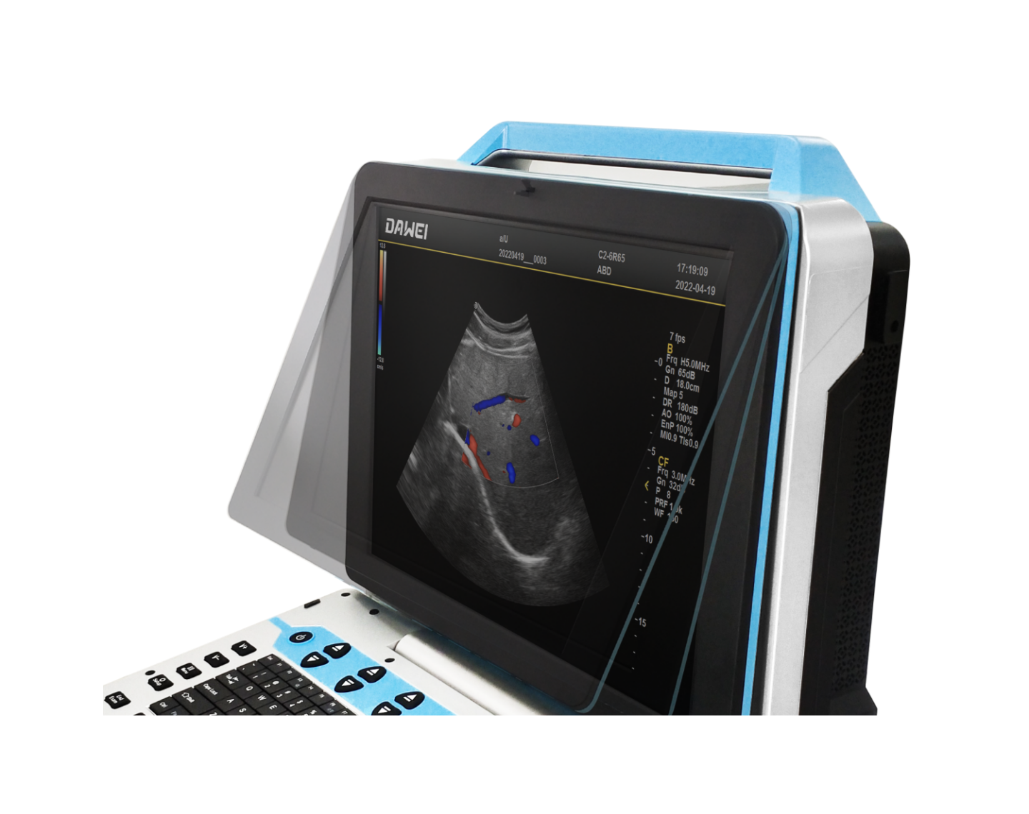 https://www.ultrasounddawei.com/best-4d5d-color-doppler-portable-ultrasound-diagnosis-system-product/