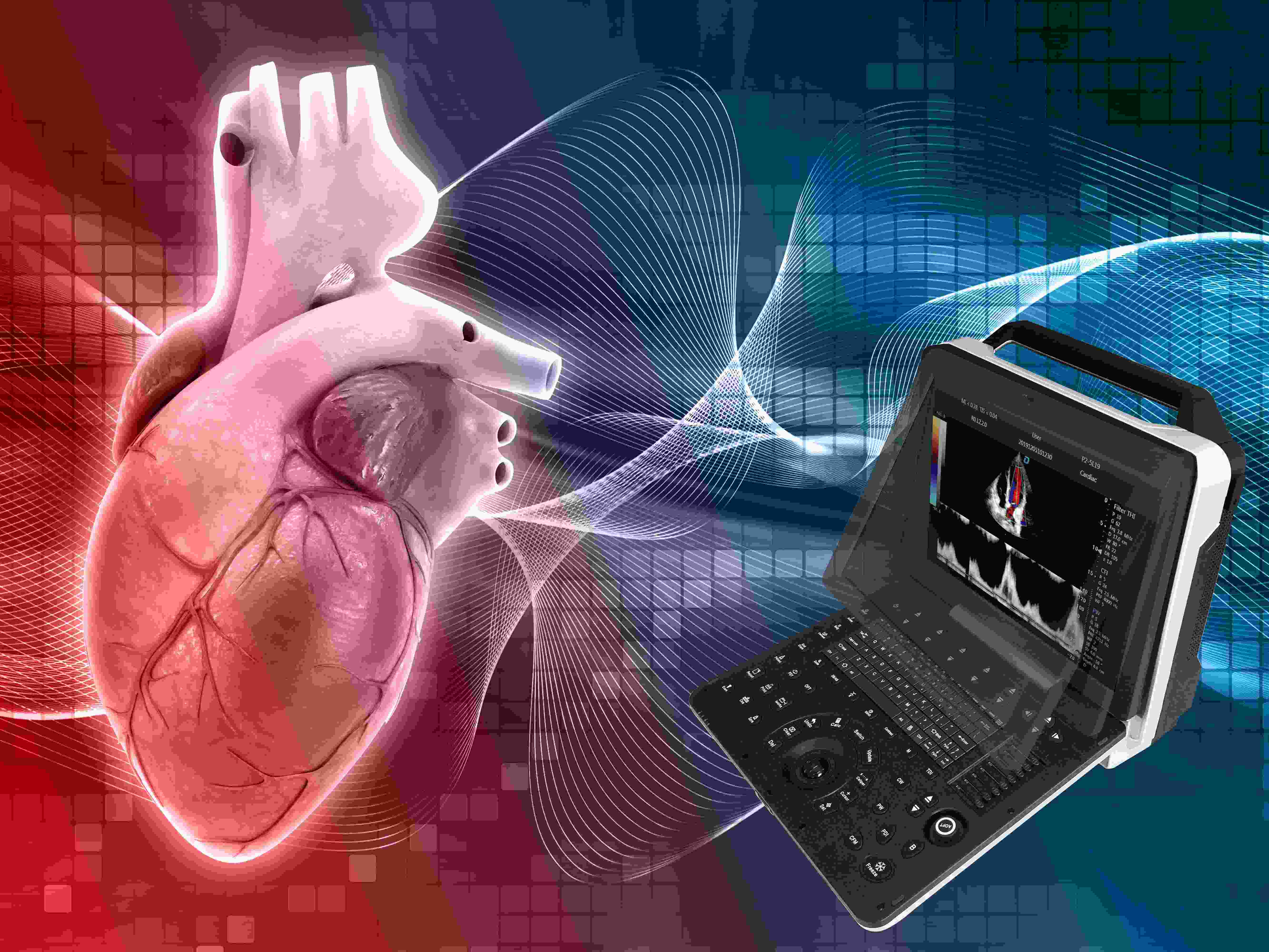 portable cardiology color ultrasound machine