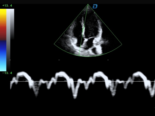 cardiac imaging