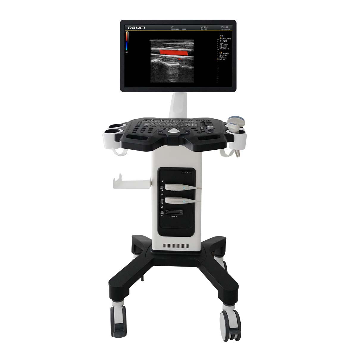 China DW-F3 trolley color doppler medical ultrasound scanner system ...